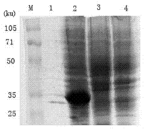 Anthropogenic LMP1 (latent membrane protein1) extracellular regional antibody for nasopharyngeal carcinoma and application thereof