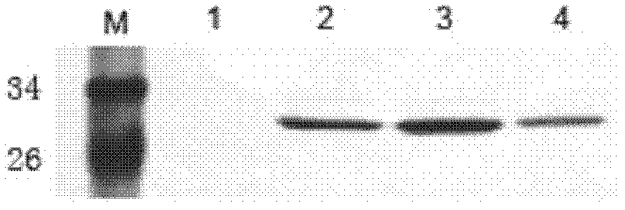 Anthropogenic LMP1 (latent membrane protein1) extracellular regional antibody for nasopharyngeal carcinoma and application thereof