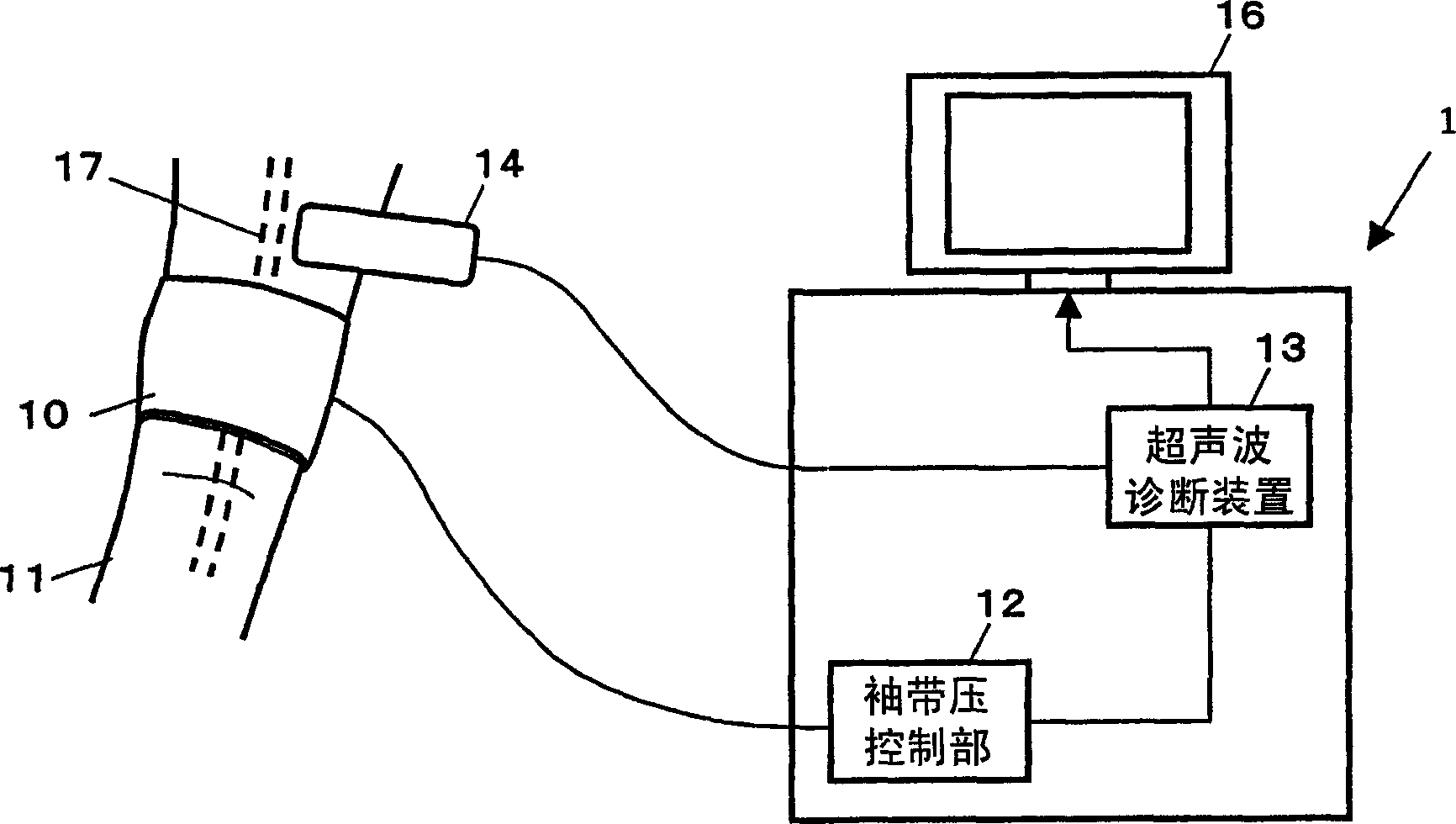 Vascular endothelial reactivity measuring apparatus and method for controlling the measuring apparatus