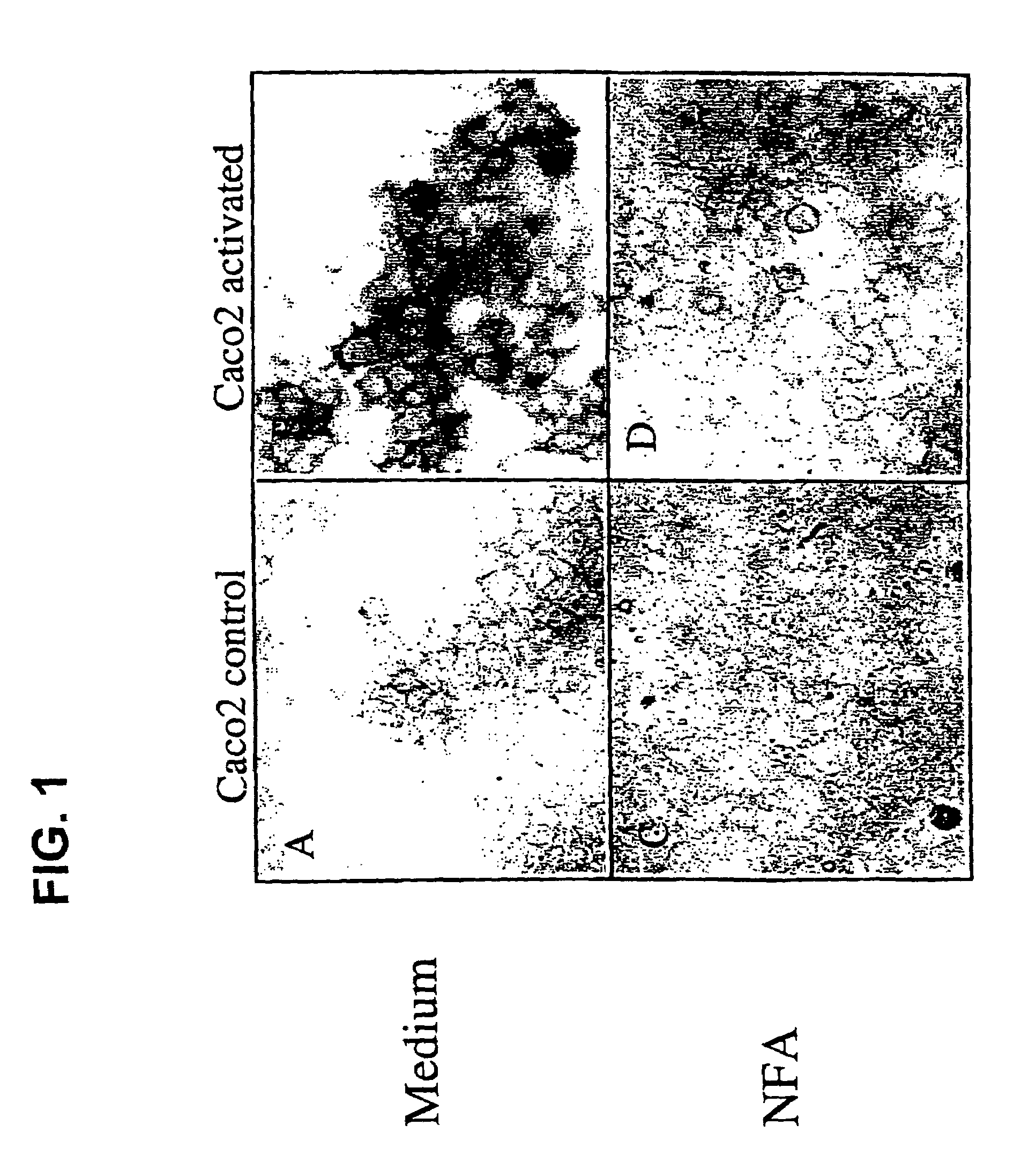 Mucin synthesis inhibitors