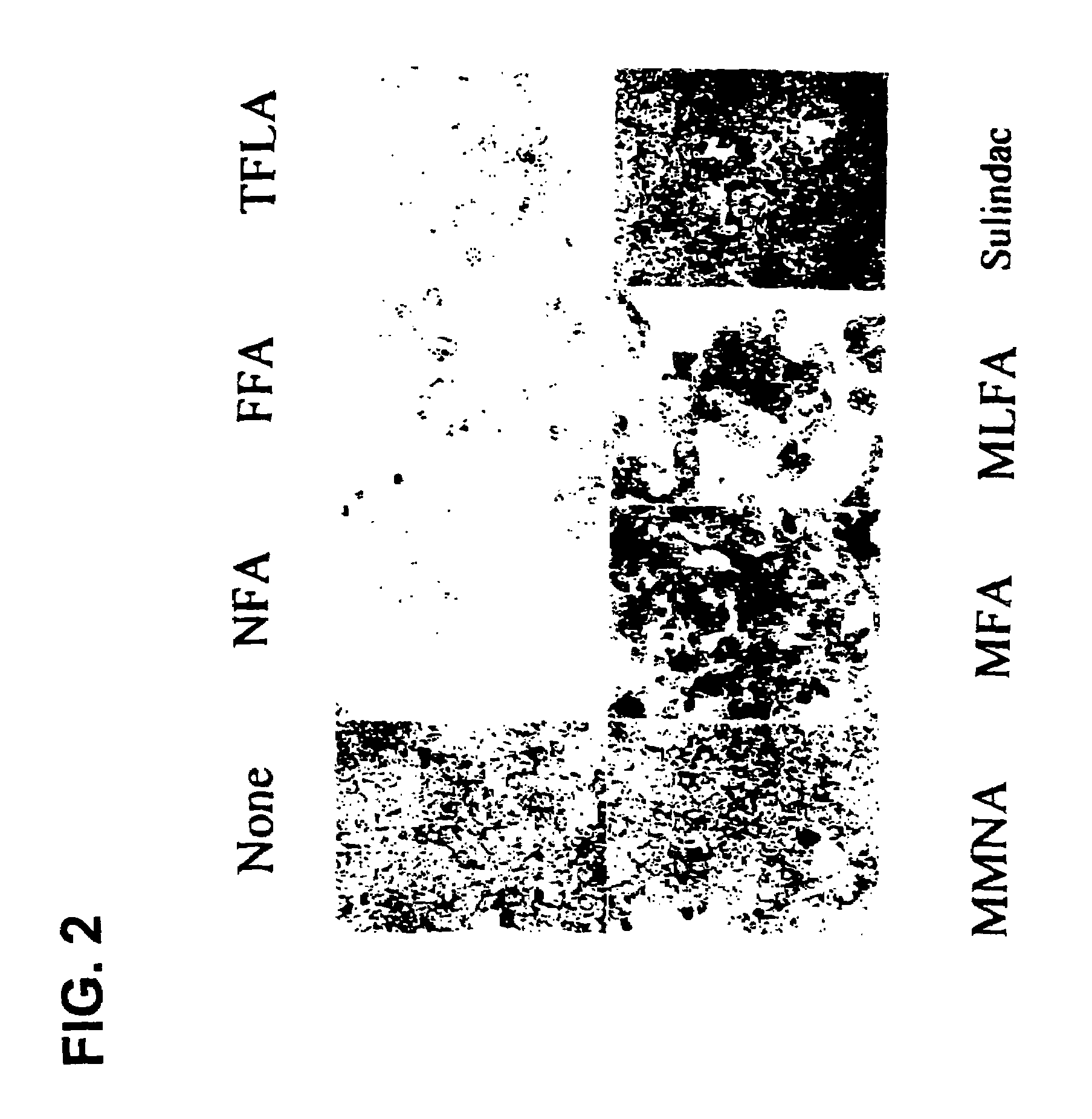 Mucin synthesis inhibitors