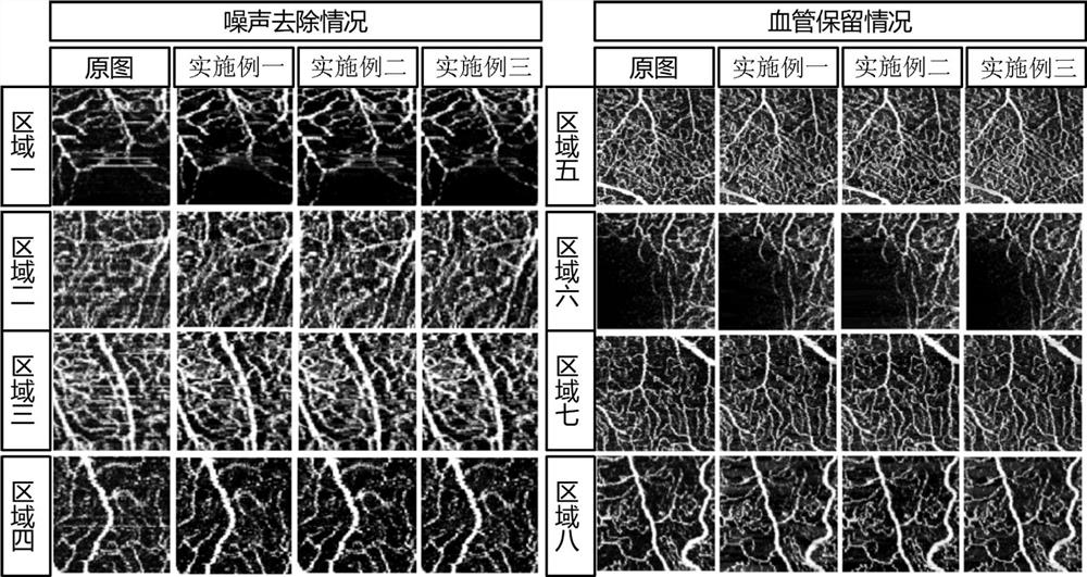 A Method of Image Noise Removal About Oct and Octa