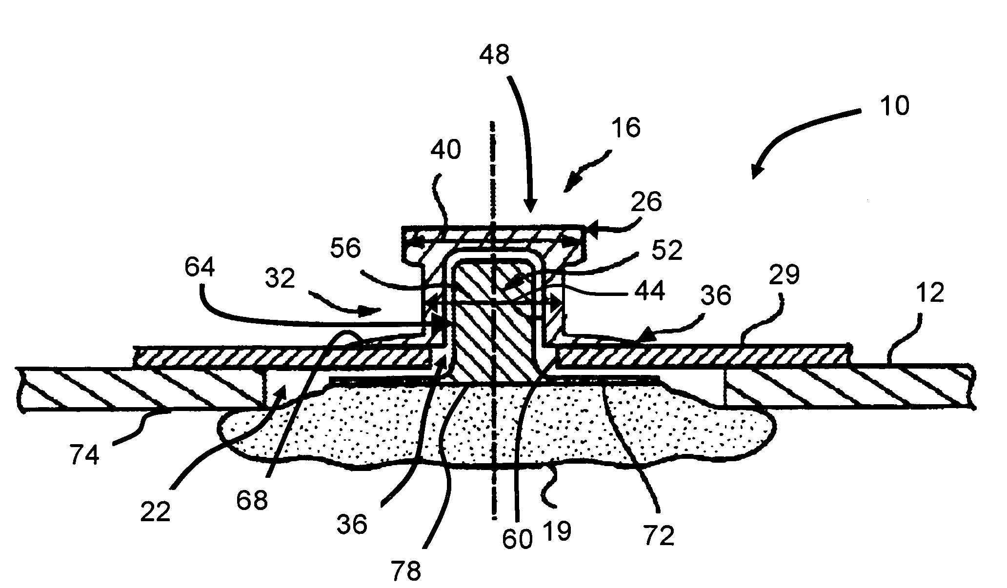 Methods and apparatus for conducting electrical current