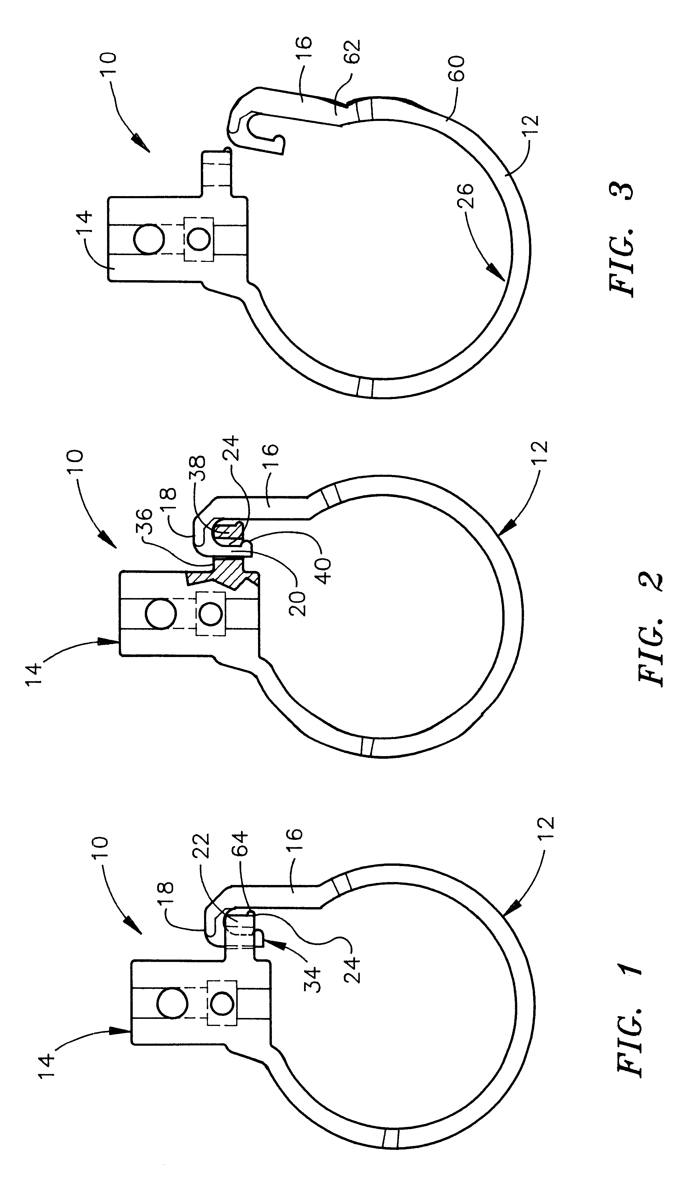 Locking cable support