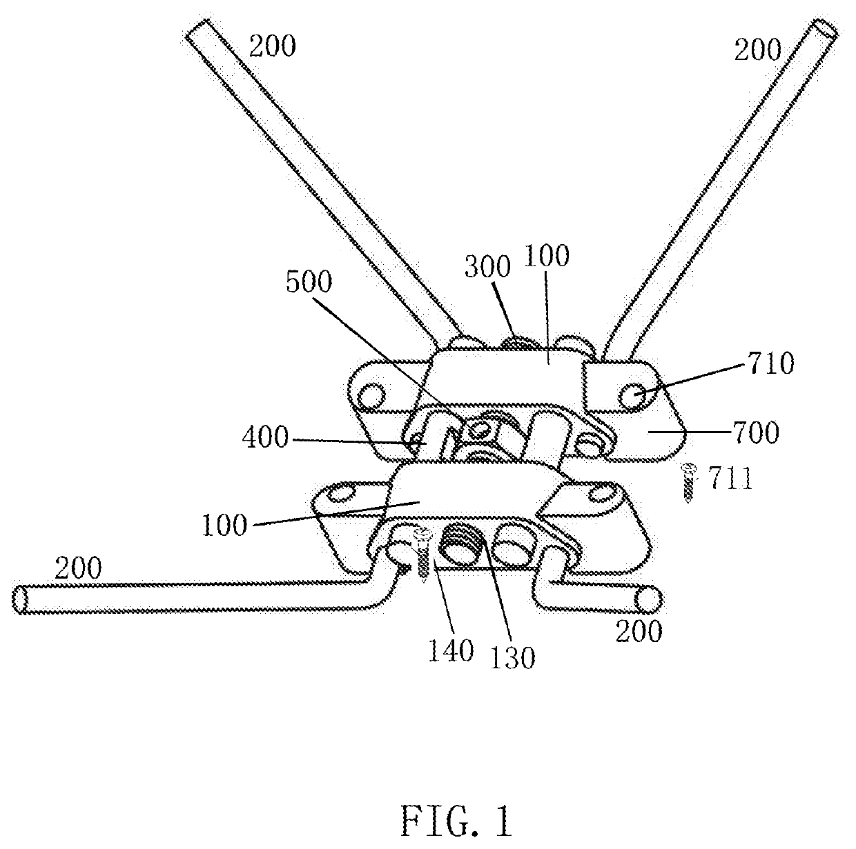 Novel maxillary skeletal expander device (m-marpe) and method