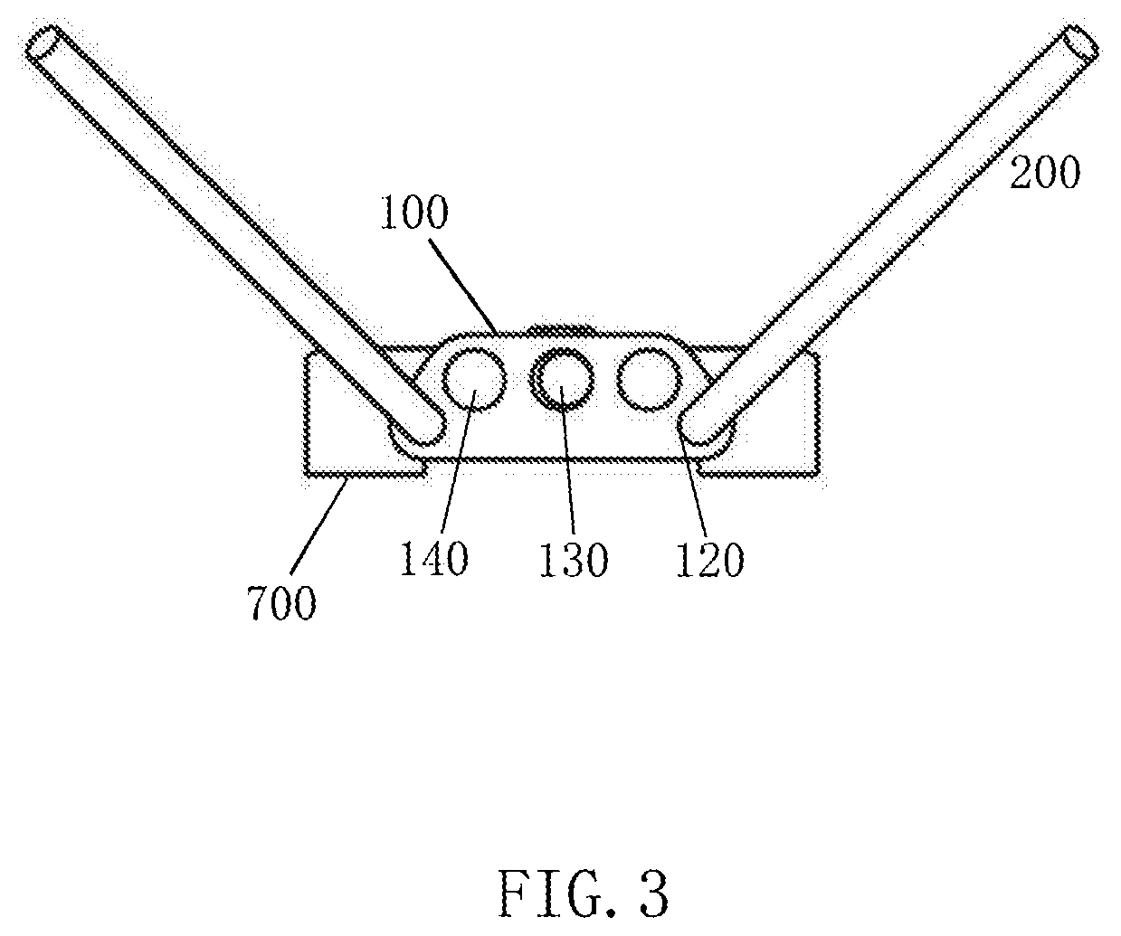 Novel maxillary skeletal expander device (m-marpe) and method