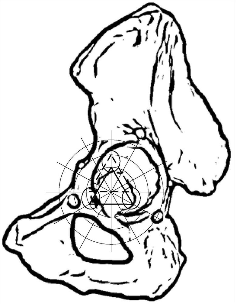 Pelvis registration method, pelvis registration device and pelvis registration system