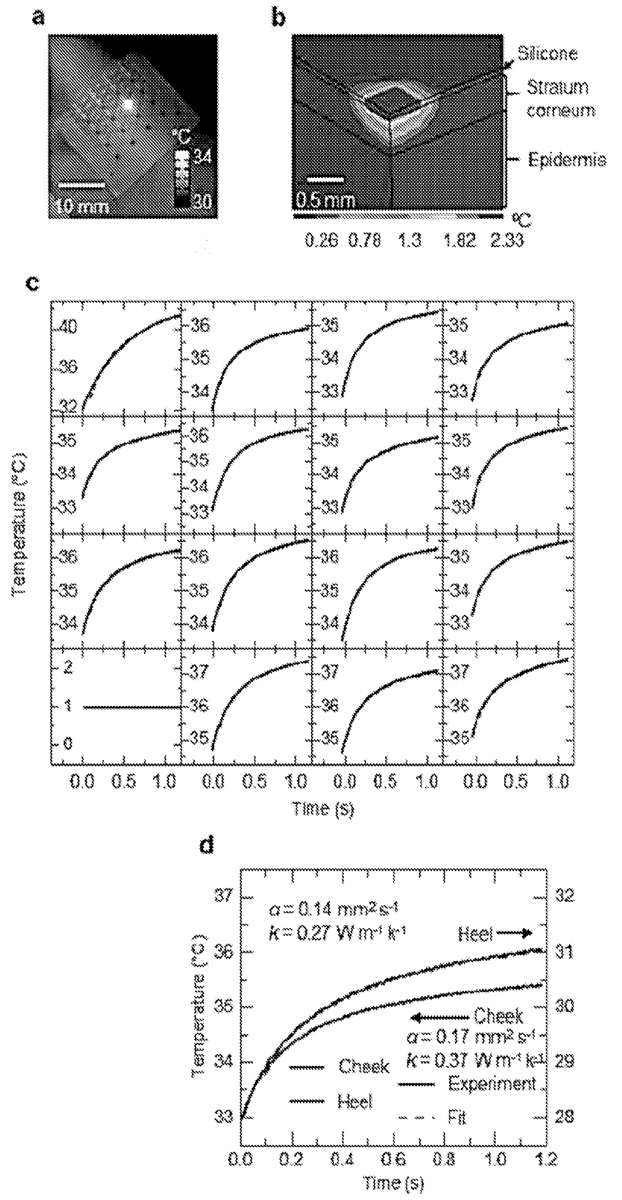 Thermal Transport Characteristics of Human Skin Measured In Vivo Using Thermal Elements