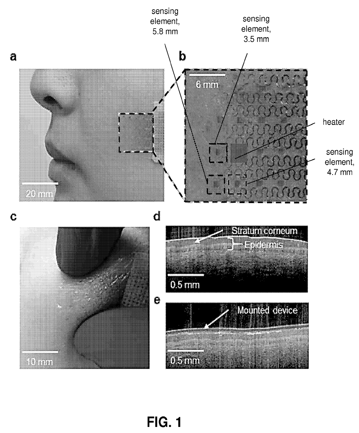 Thermal Transport Characteristics of Human Skin Measured In Vivo Using Thermal Elements