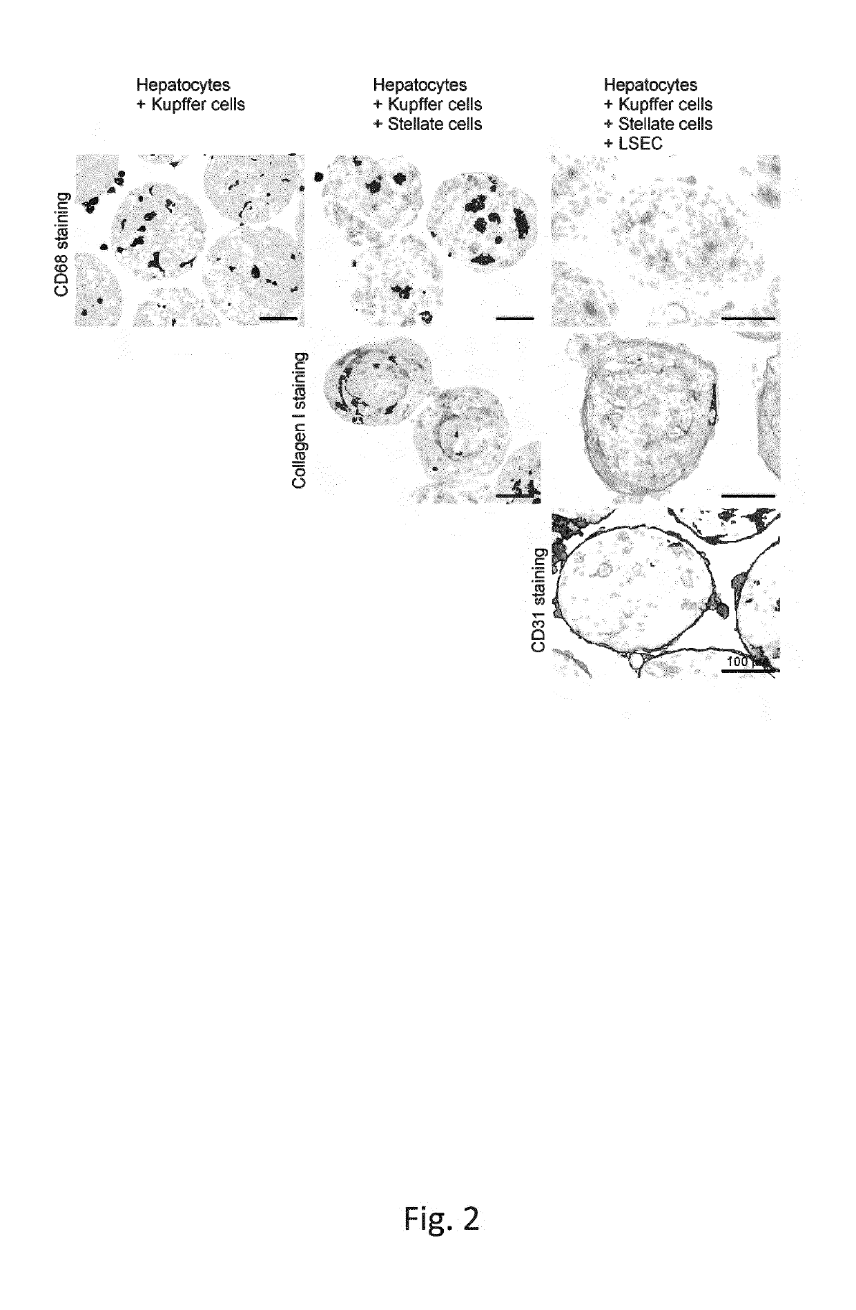 Screenable liver disease models and methods