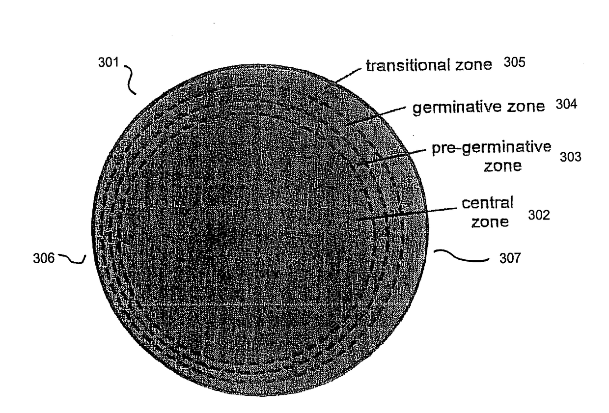 Processes and apparatus for preventing, delaying or ameliorating one or more symptoms of presbyopia