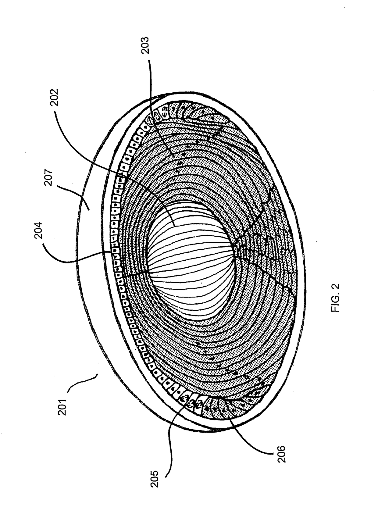 Processes and apparatus for preventing, delaying or ameliorating one or more symptoms of presbyopia