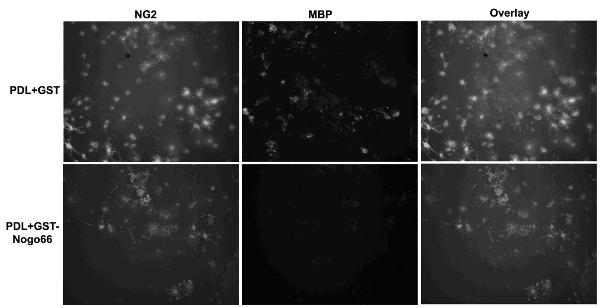 TAT-WNK102 transmembrane protein and application thereof