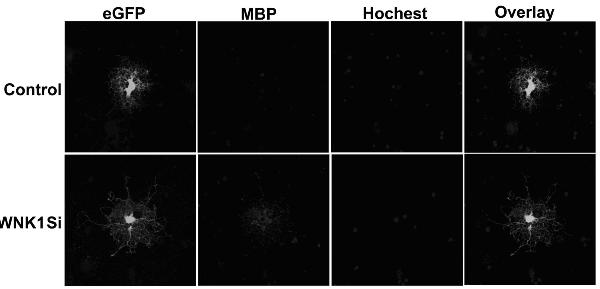 TAT-WNK102 transmembrane protein and application thereof