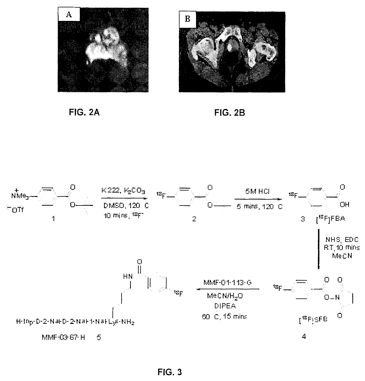 Peptidomimetics for imaging the ghrelin receptor