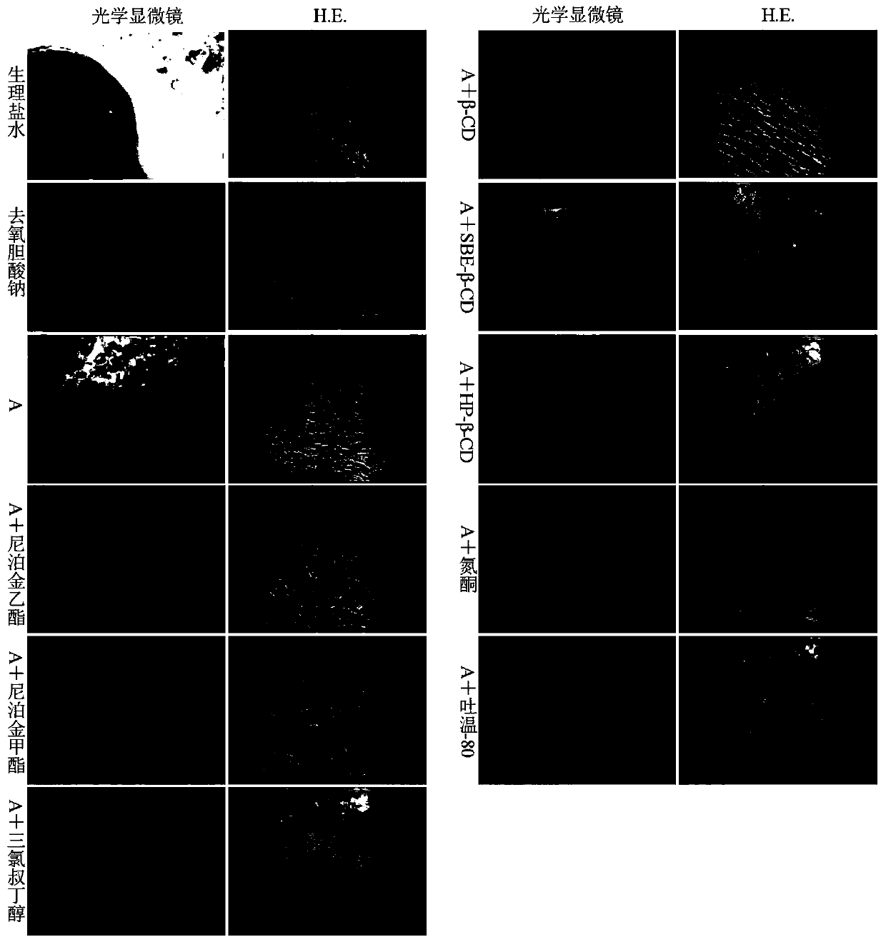 Timosaponin BII temperature/ion-sensitive nasal in-situ gel and application thereof