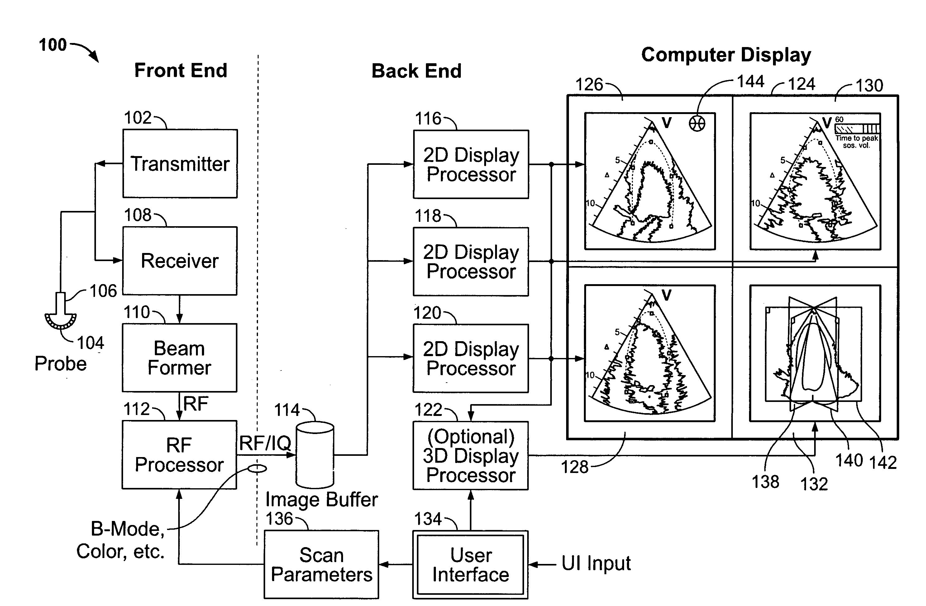 Method and apparatus for real time ultrasound multi-plane imaging