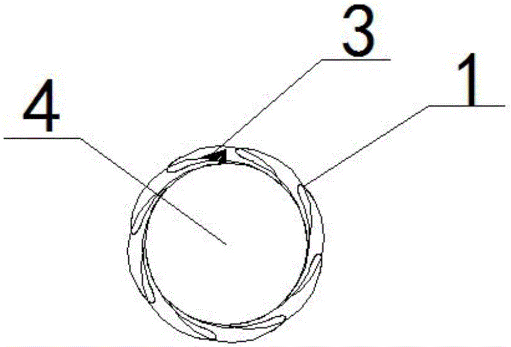 Supporting balloon capable of realizing prostate directional dilation