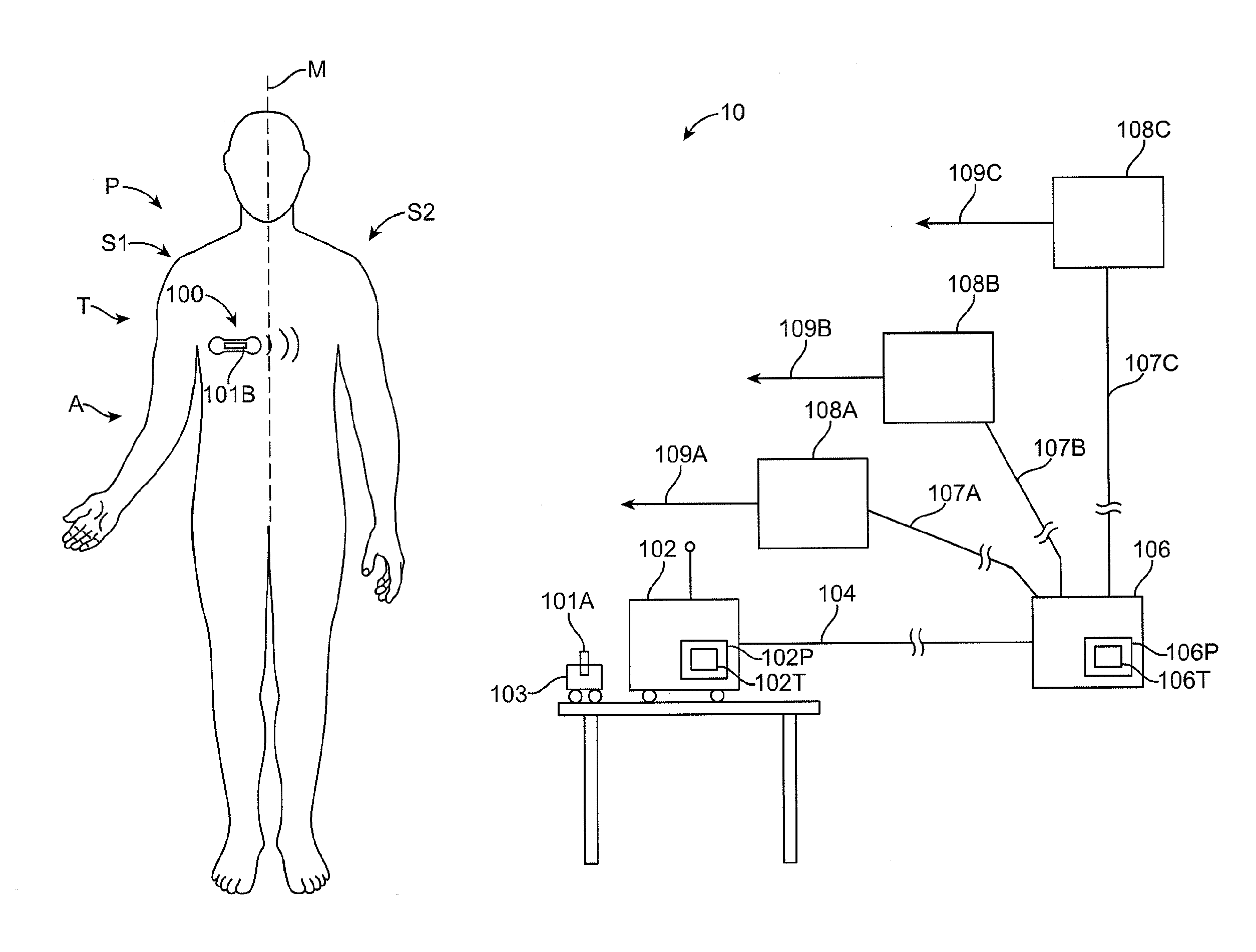 Method and Apparatus for Remote Detection and Monitoring of Functional Chronotropic Incompetence