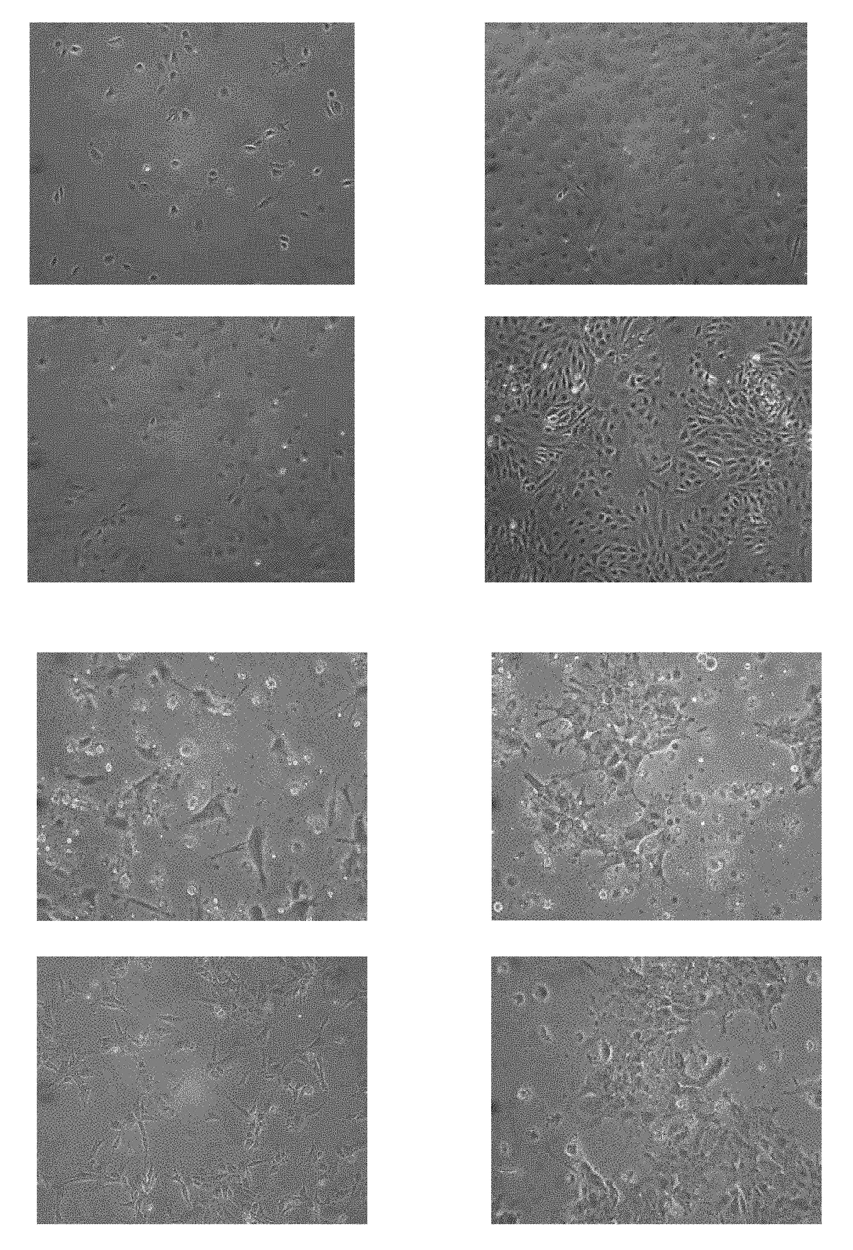 Induction of pancreatic beta cells by stem cell differentiation with RNA