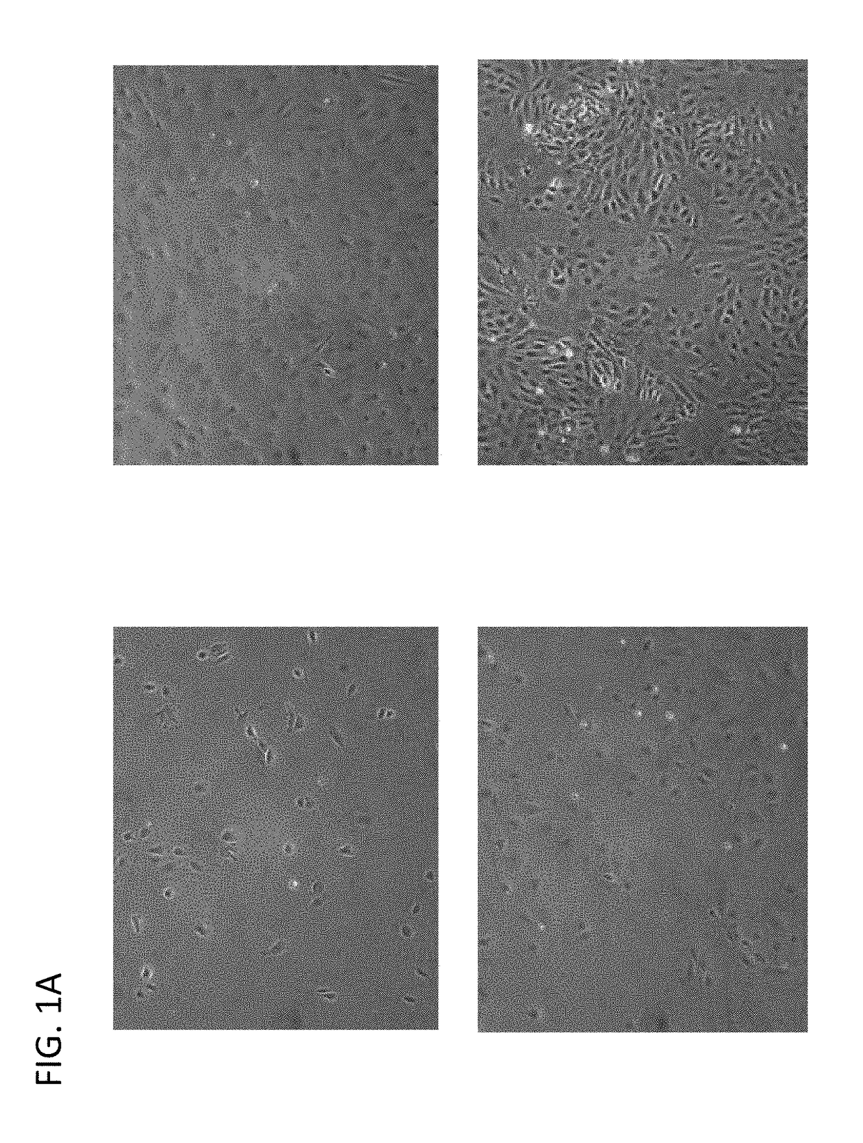 Induction of pancreatic beta cells by stem cell differentiation with RNA