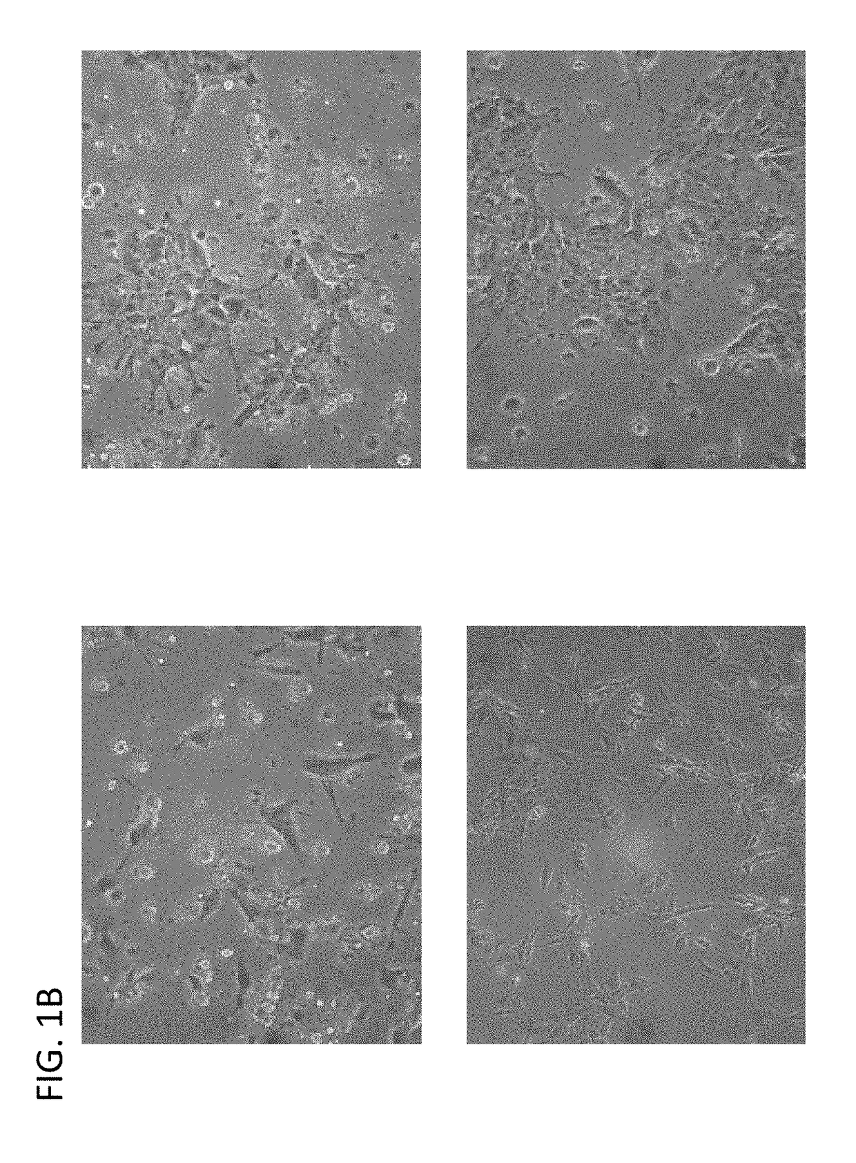 Induction of pancreatic beta cells by stem cell differentiation with RNA