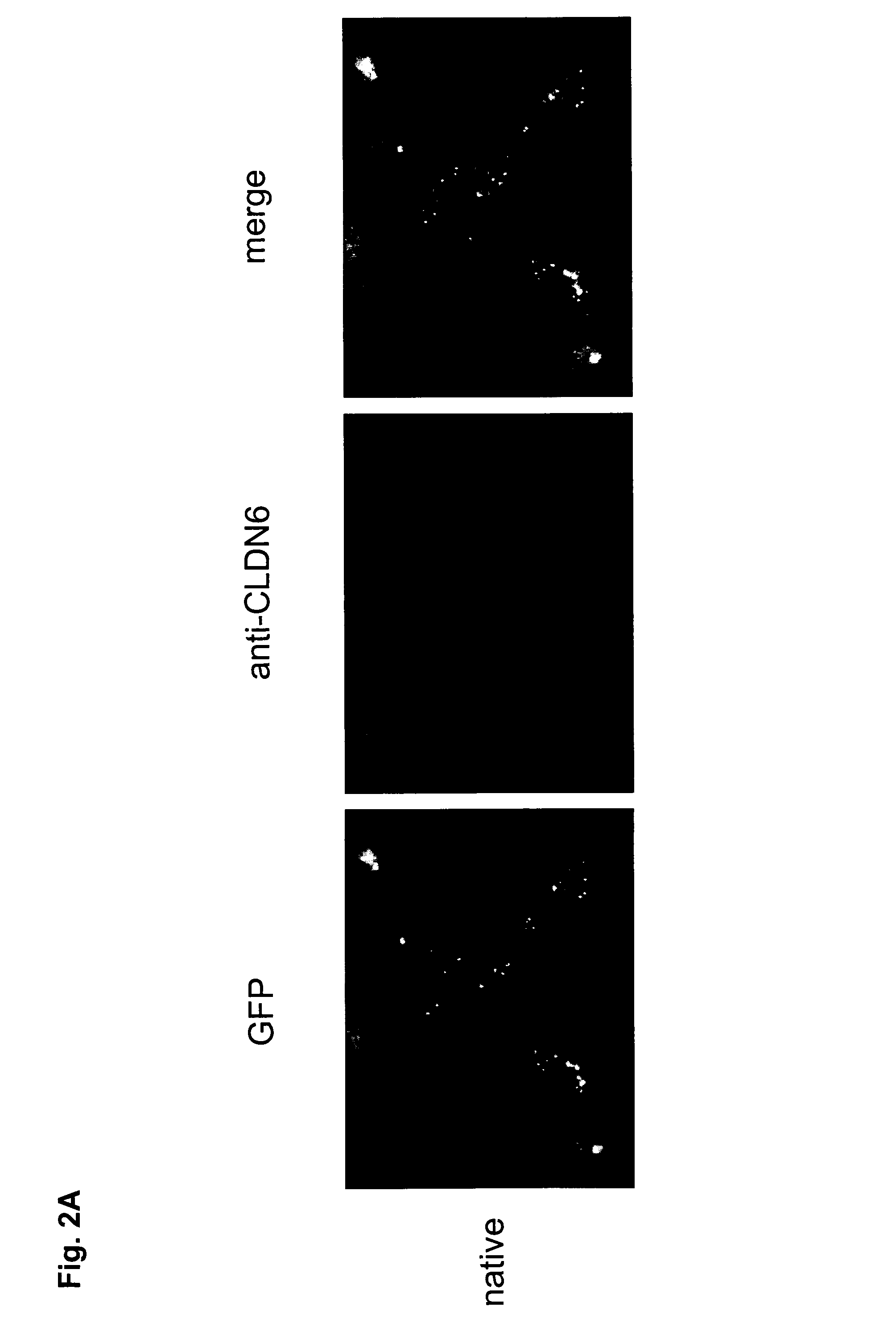 Antibodies for treatment of cancer