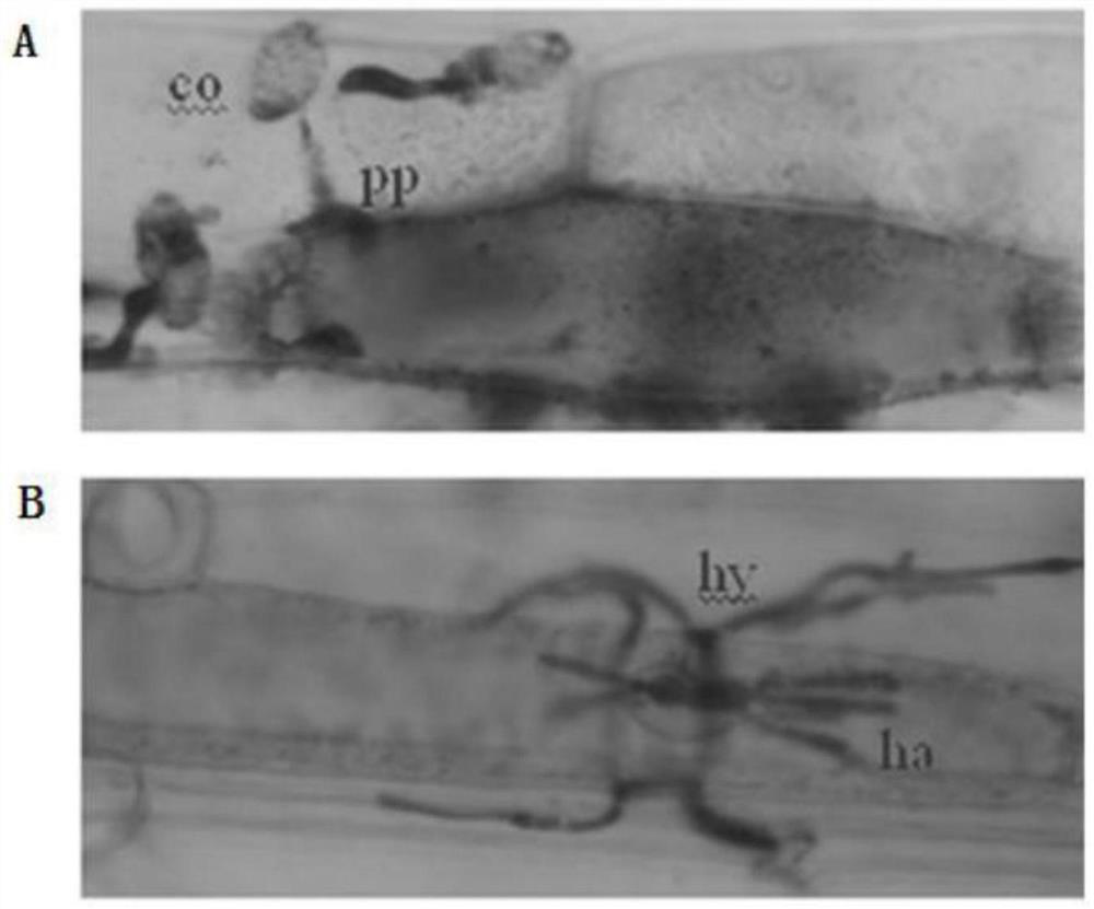 A kinase gene lerlk1-v and its expression vector and application