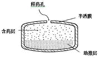 A kind of glipizide controlled-release composition and preparation method thereof