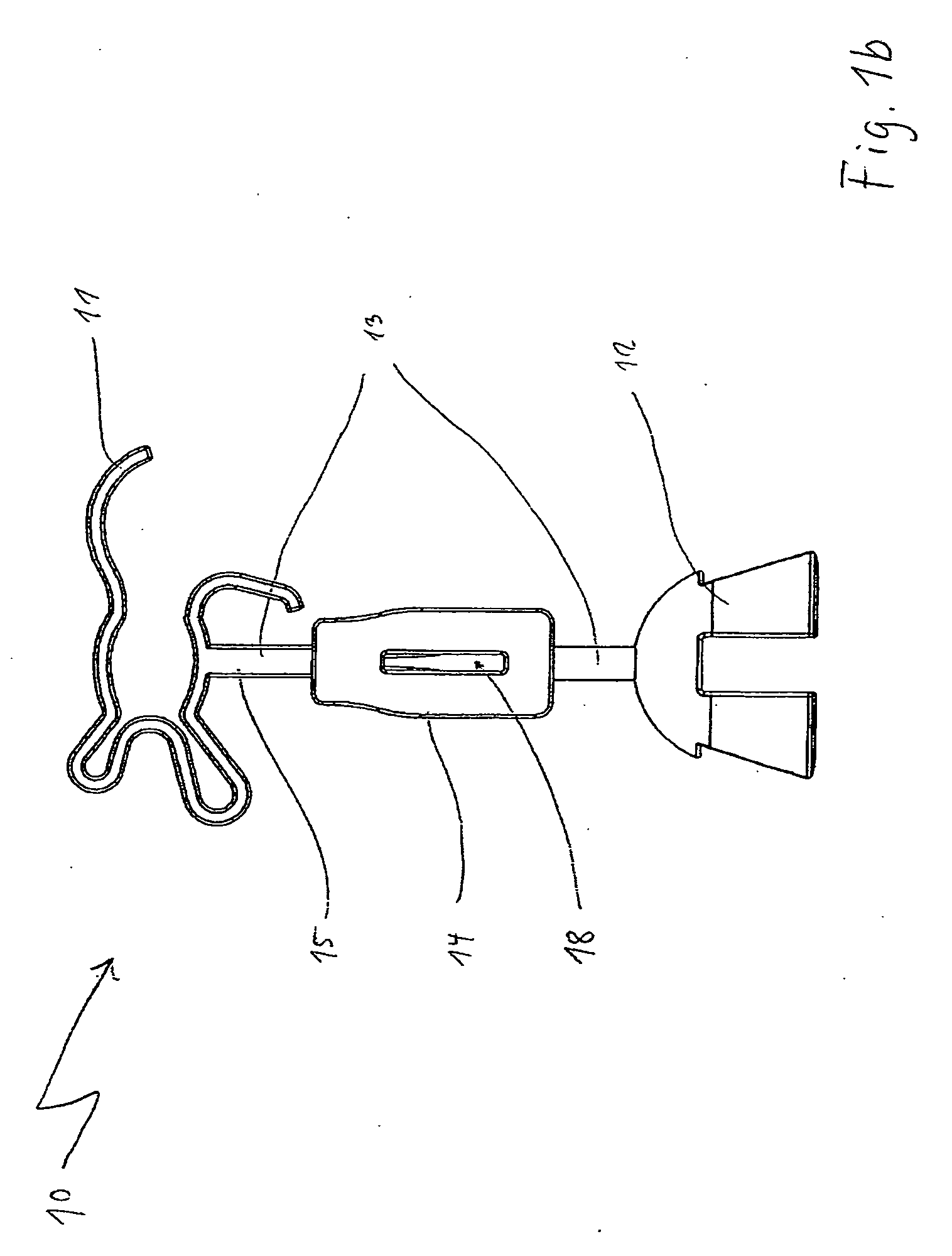 Length-variable auditory ossicle prosthesis