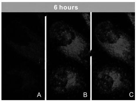 A kind of material loaded with antitumor drug and preparation method thereof