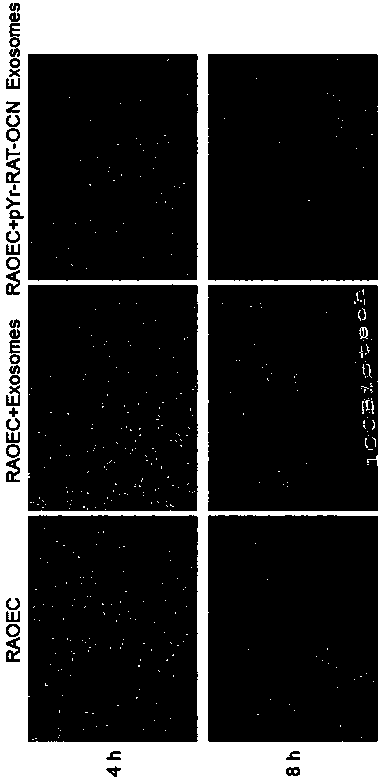 Application of osteocalcin in the regulation of endothelial progenitor exosomes