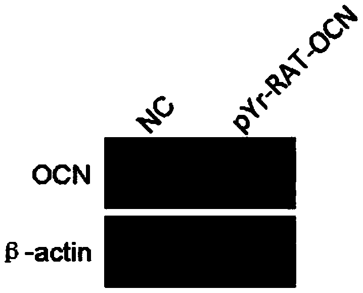 Application of osteocalcin in the regulation of endothelial progenitor exosomes