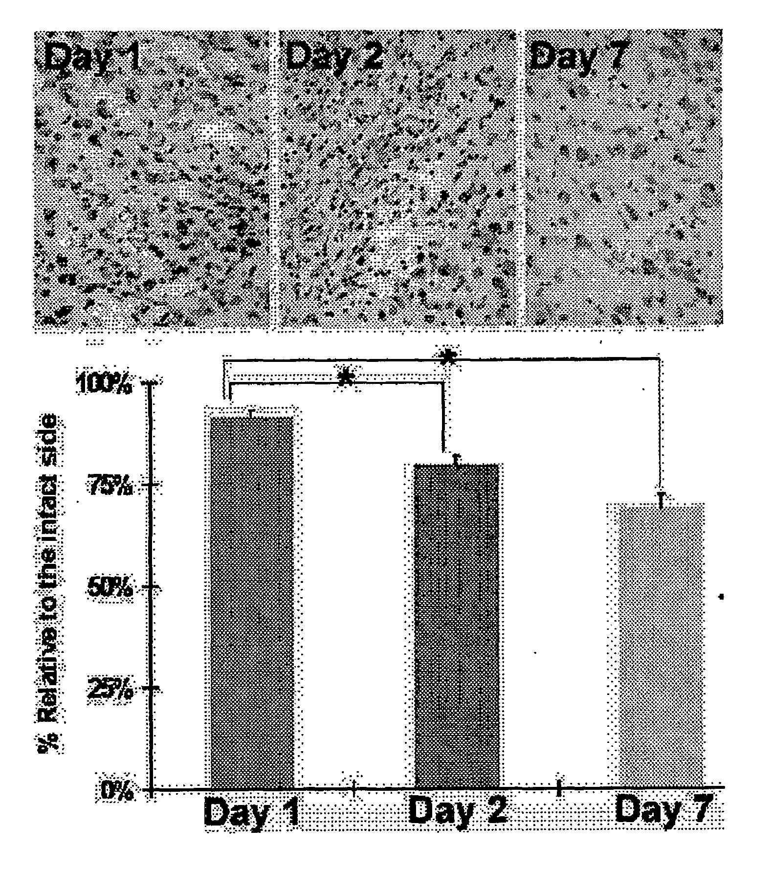 MAPC Therapeutics Without Adjunctive Immunosuppressive Treatment