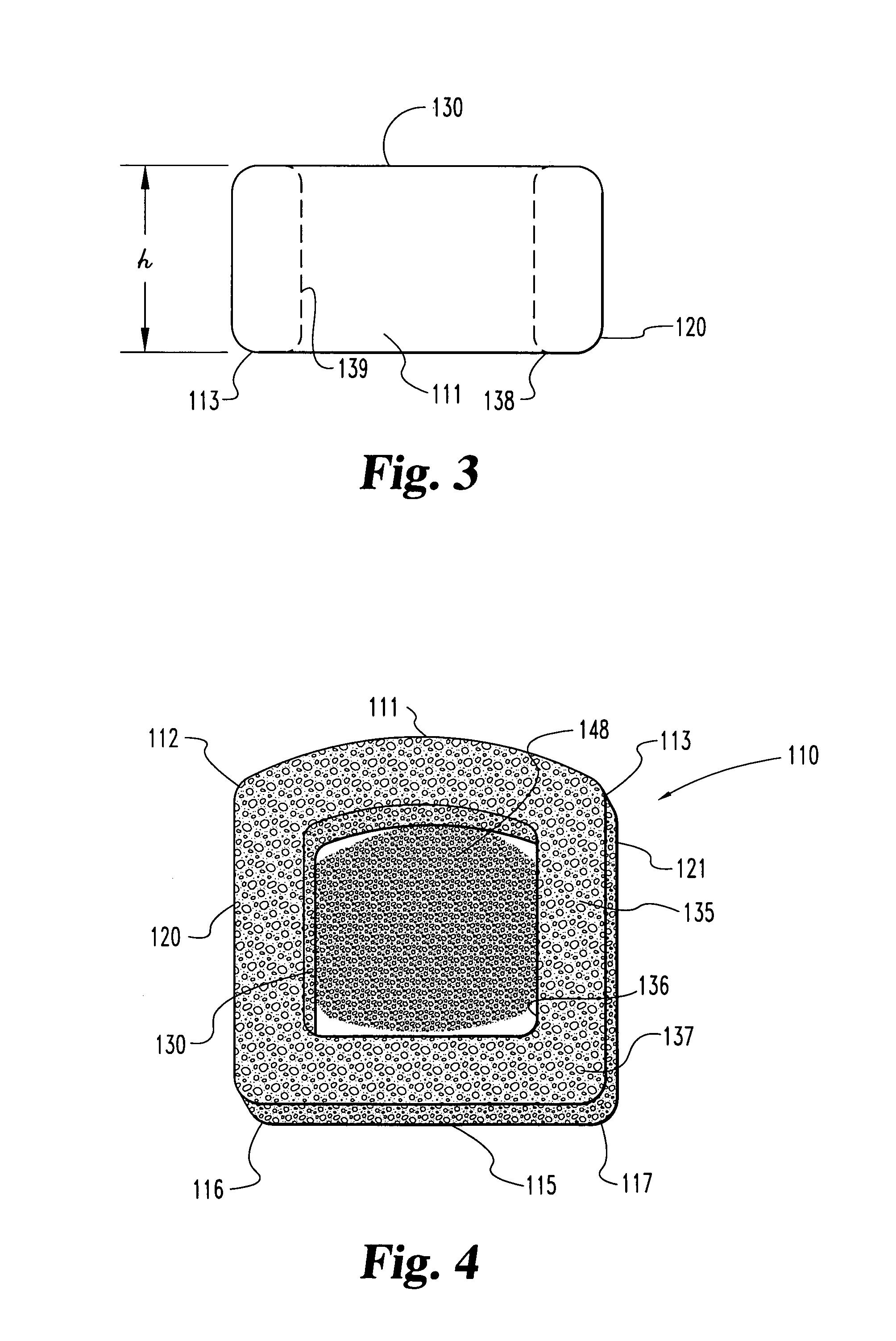 Bone grafts