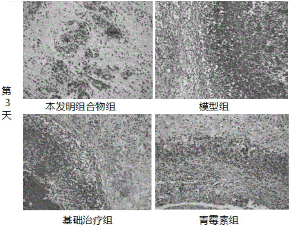 Traditional Chinese medicinal composition for treating diabetic foot ulcer, positive ulcer and positive sore and preparation method of traditional Chinese medicinal composition