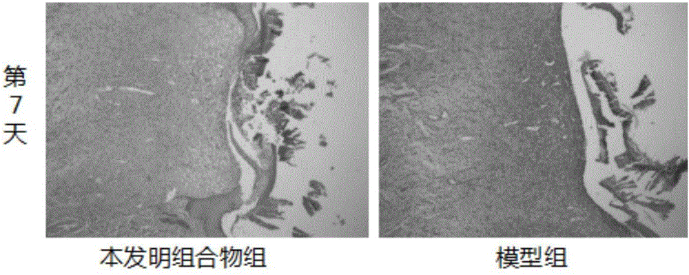 Traditional Chinese medicinal composition for treating diabetic foot ulcer, positive ulcer and positive sore and preparation method of traditional Chinese medicinal composition