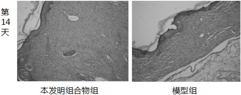 Traditional Chinese medicinal composition for treating diabetic foot ulcer, positive ulcer and positive sore and preparation method of traditional Chinese medicinal composition