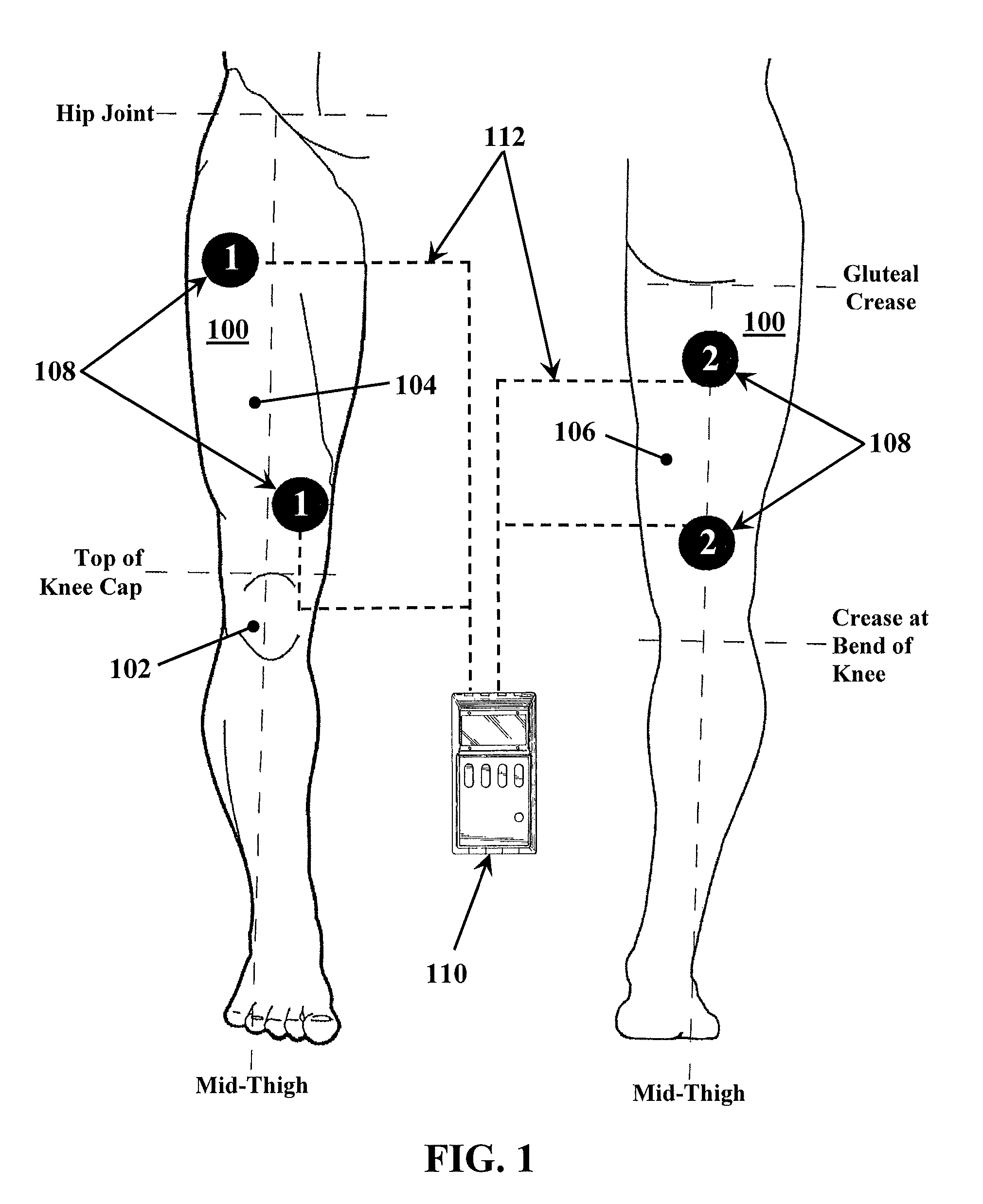 Apparatus and method for stabilizing, improving mobility, and controlling cartilage matrix degradation of weight-bearing articular joints