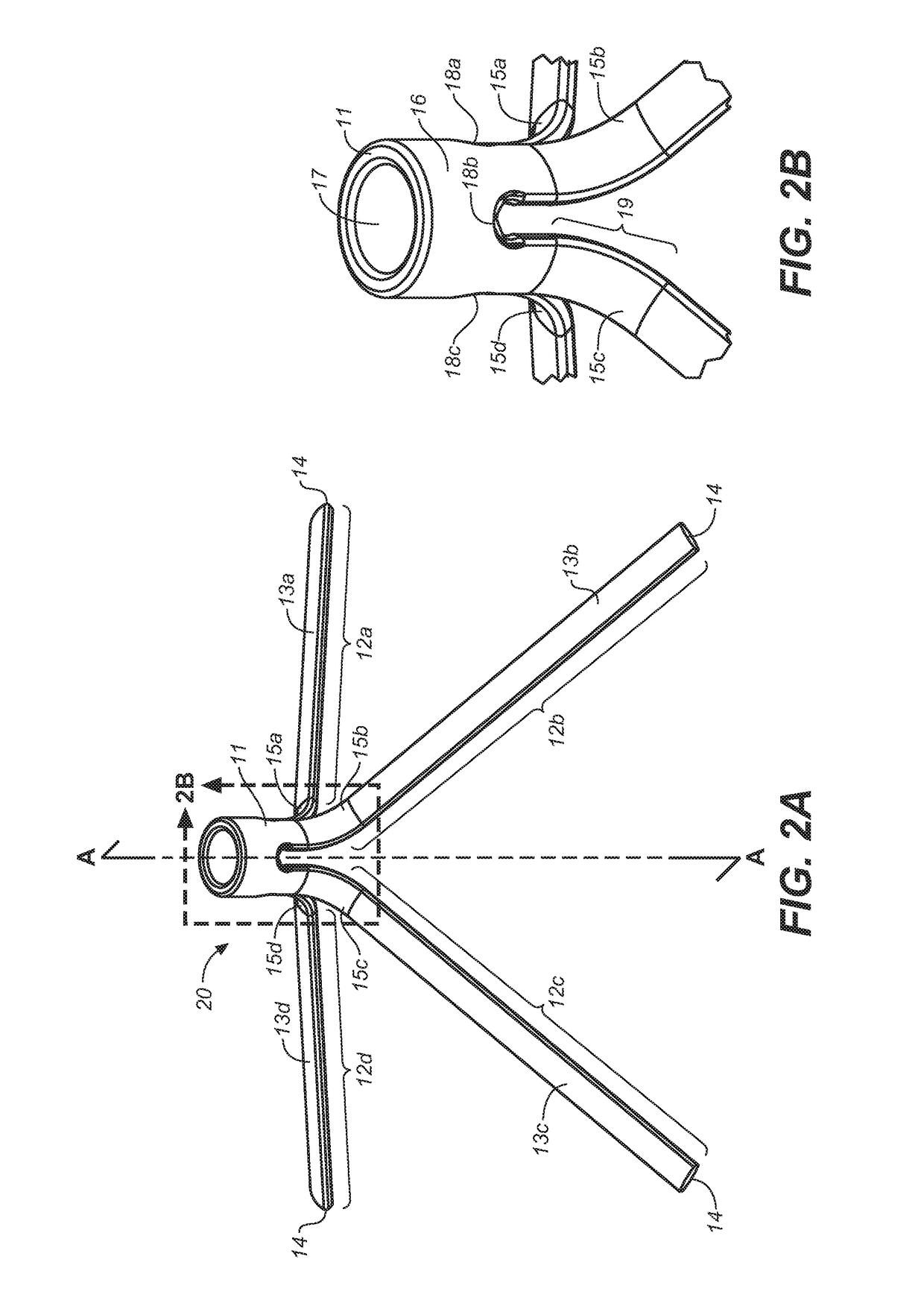 Implantable devices and methods to treat benign prostate hyperplasia (BPH) and associated lower urinary tract symptoms (LUTS)