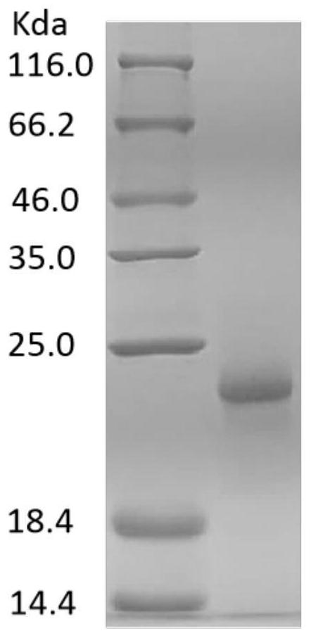 DNA sequences encoding African swine fever virus antigens, compositions of antigens encoded by them and their application in immunological detection