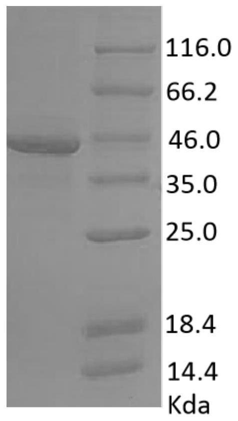 DNA sequences encoding African swine fever virus antigens, compositions of antigens encoded by them and their application in immunological detection