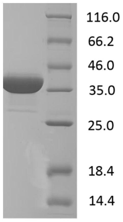 DNA sequences encoding African swine fever virus antigens, compositions of antigens encoded by them and their application in immunological detection