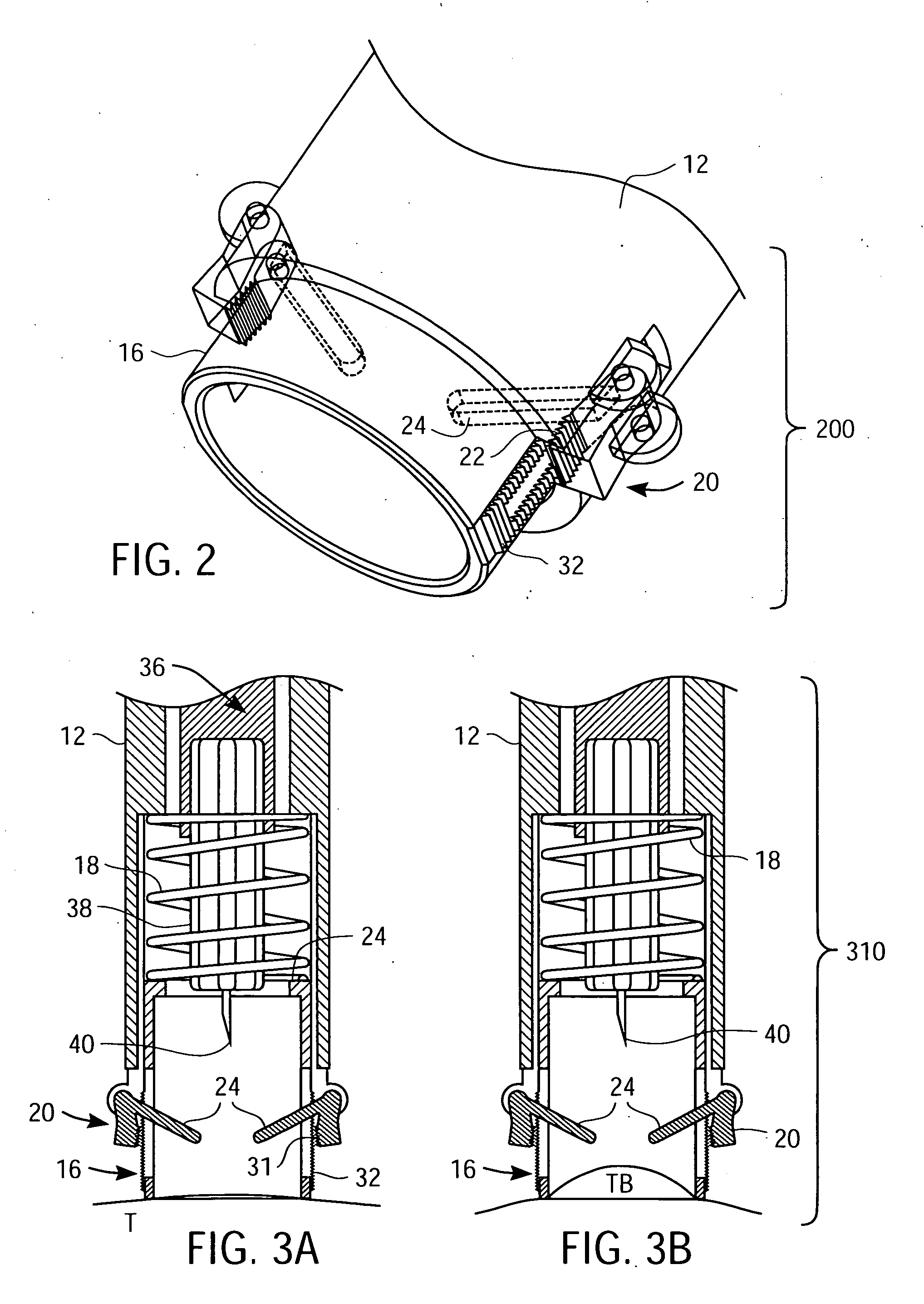 Lancing device with trigger mechanism for penetration depth control