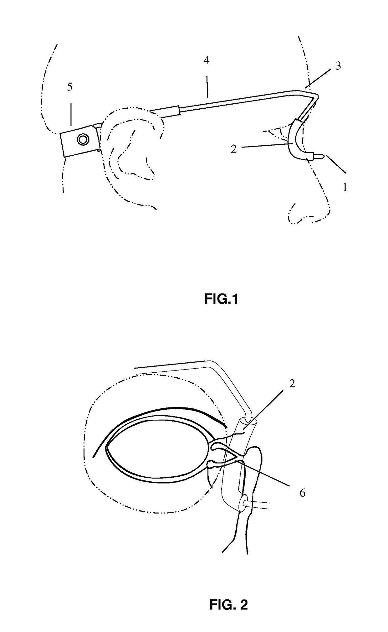 Nasolacrimal Compression Device