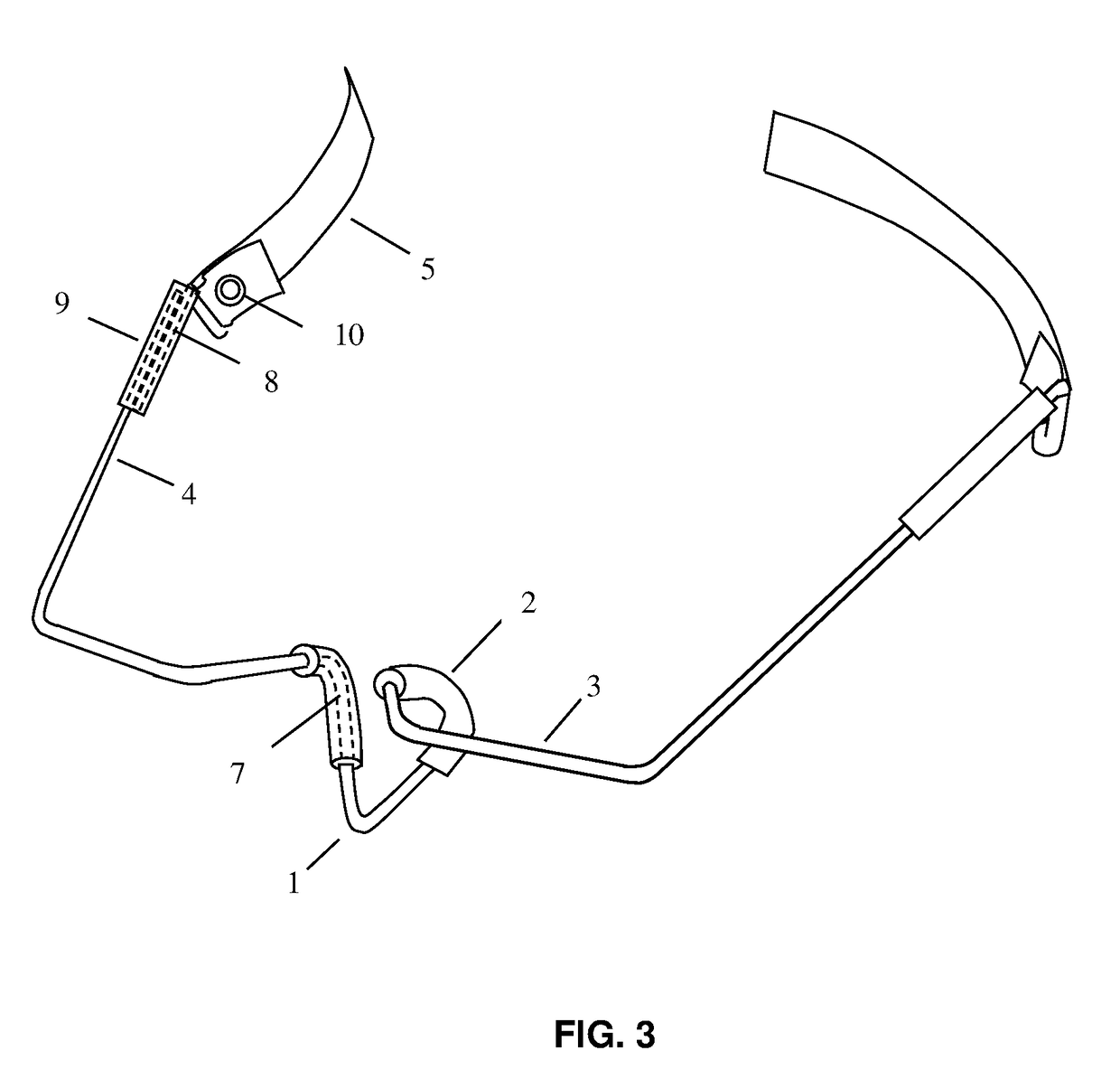 Nasolacrimal Compression Device