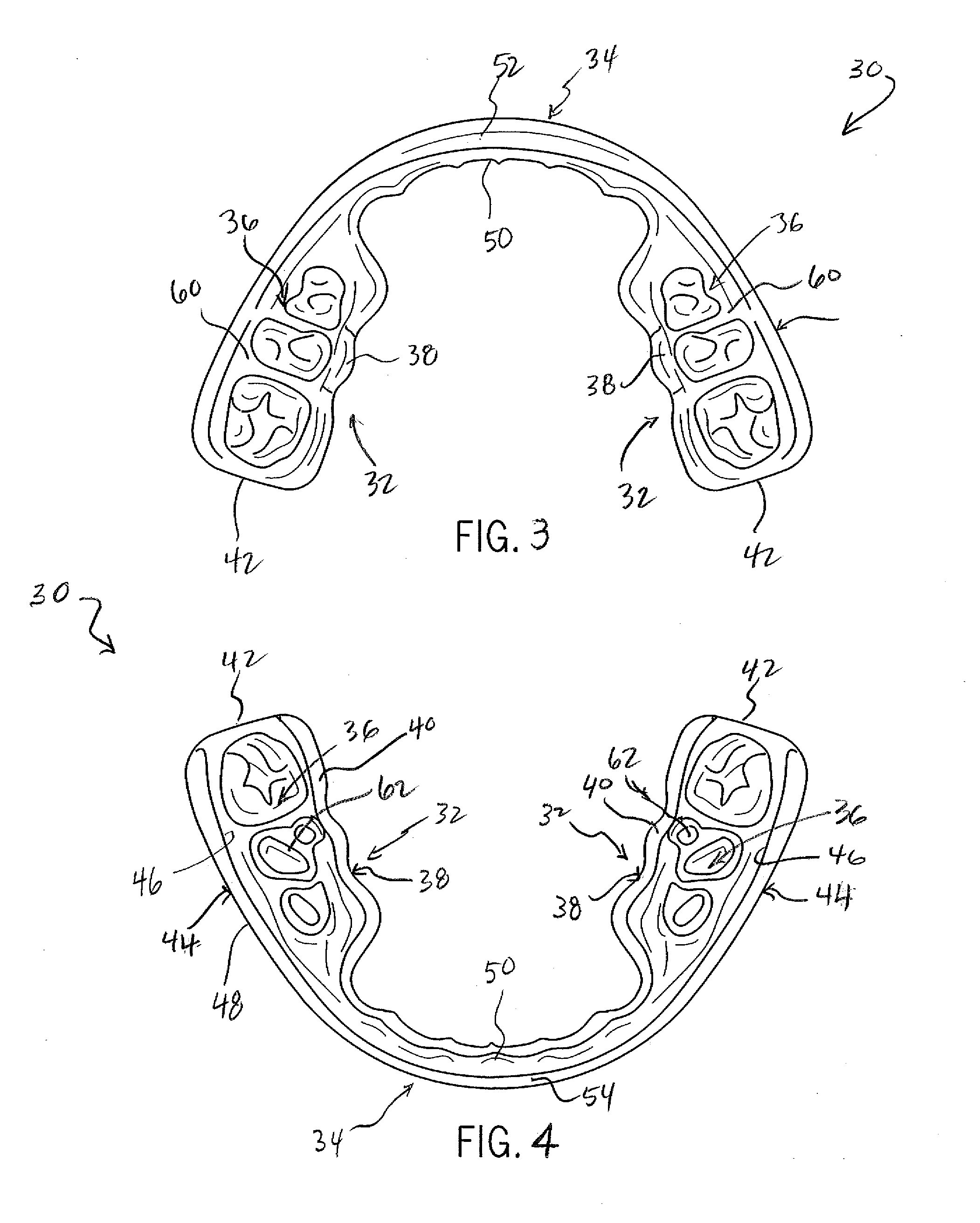 Performance Enhancing Bite Regulator and Method of Custom Fitting Same