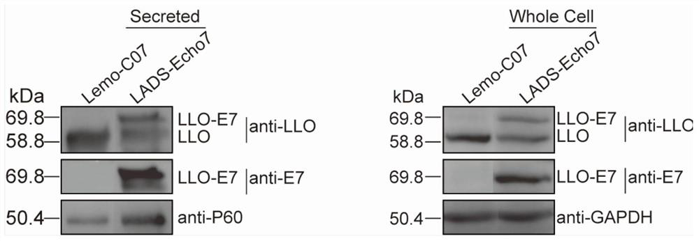 Cervical cancer therapeutic vaccine based on recombinant attenuated Listeria monocytogenes and preparation method of cervical cancer therapeutic vaccine