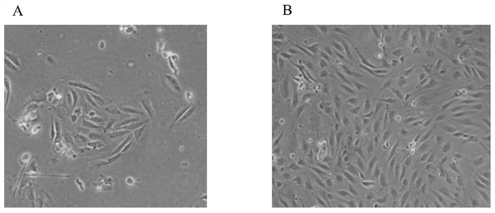 Isolation and in vitro expansion method of human vein endothelial cells