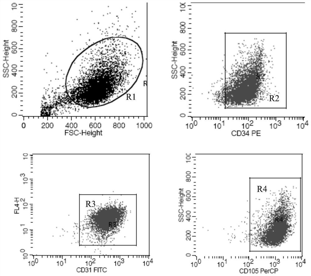 Isolation and in vitro expansion method of human vein endothelial cells